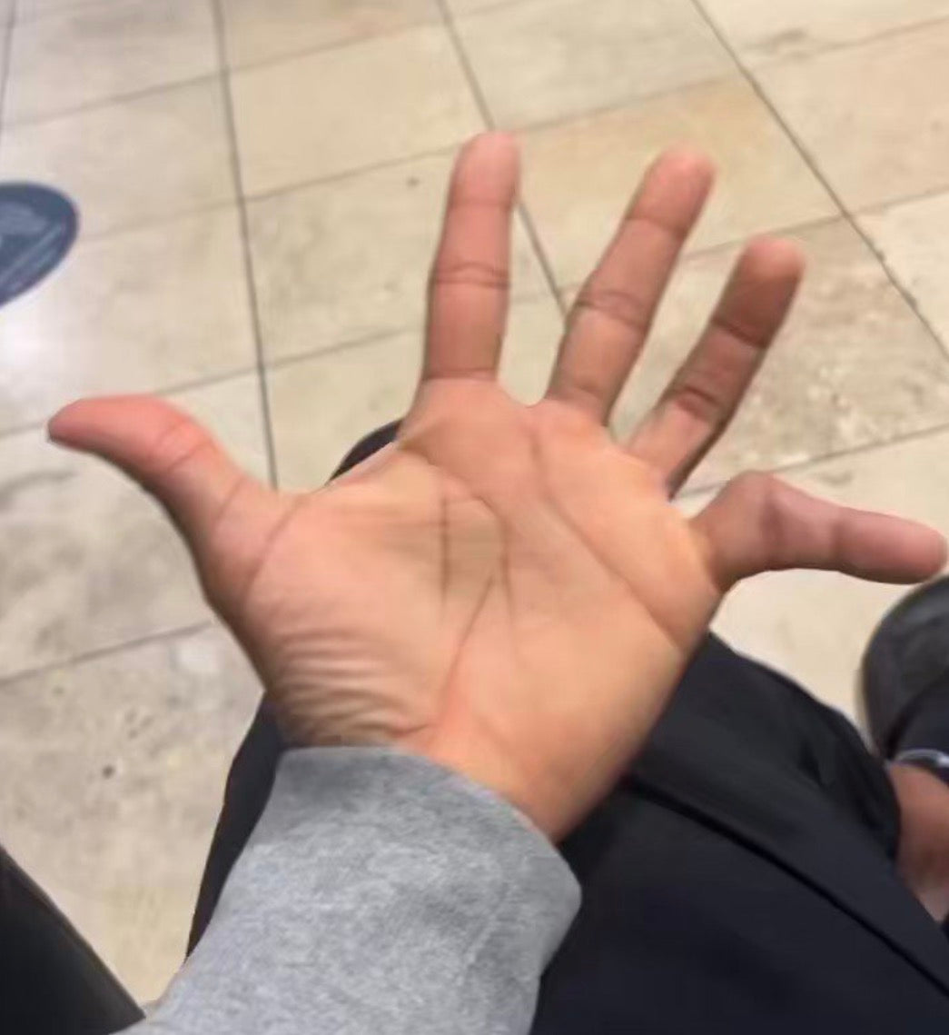 How to Prevent Pinky Injuries in Sports.